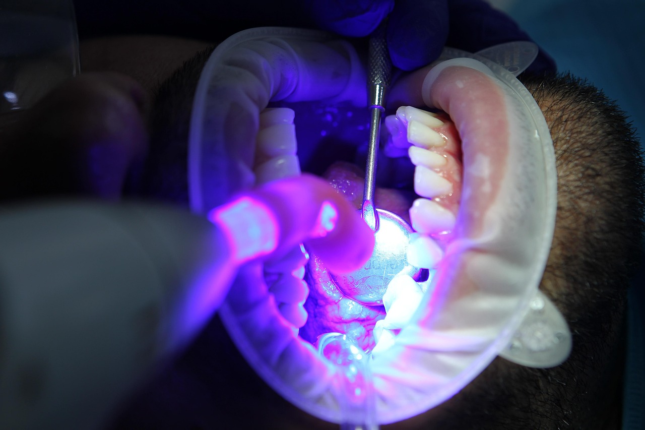 La estética dental es cada vez más importante